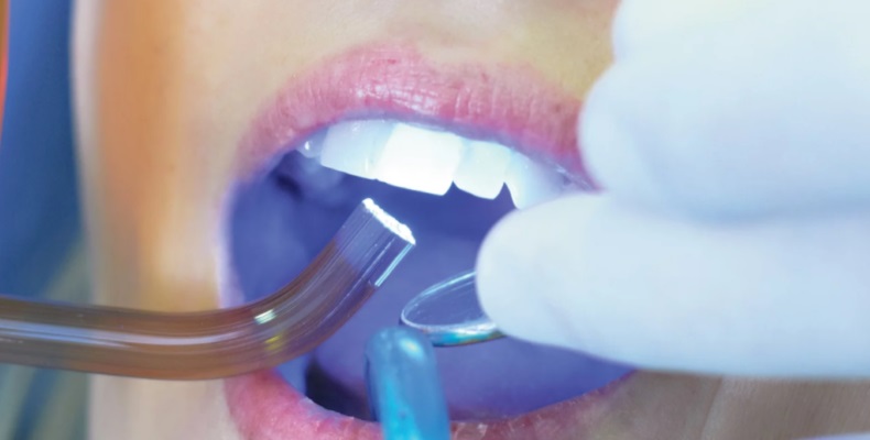 Можно ли отбелить пломбу на переднем зубе